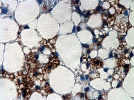 This image shows small brown-fat cells&mdash;which burn energy as heat&mdash;interspersed among larger white-fat cells, which store energy. The former are stained brown here; their natural color, which results from the density of mitochondria, would not be visible in this thin cross-section of tissue. (The blue staining marks cell nuclei.)