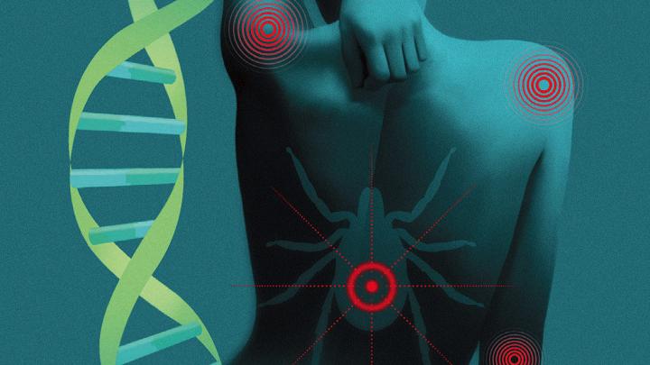 Abstract illustration of DNA, a patient's back with multiple bullseye rashes, and a deer tick.