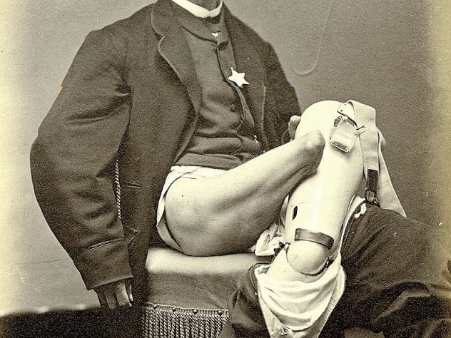 Image courtesy of the Center for the History of Medicine/Francis A. Countway Library of Medicine Civil War amputee Charles T. Green, photographed by William Bell (circa 1864)
