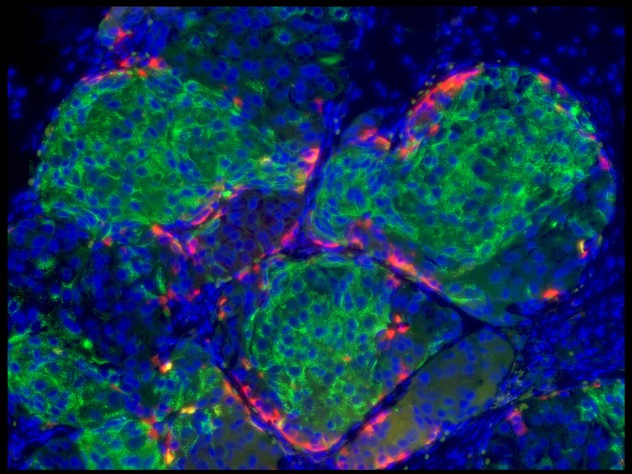Images courtesy of Douglas Melton The image shows human-stem-cell-derived beta cells that have formed islet-like clusters in a mouse. The cells were transplanted to the kidney capsule (the fibrous connective layer surrounding the kidneys); the photograph was taken two weeks later, by which time the beta cells were making insulin and had cured the diabetes in the mouse.