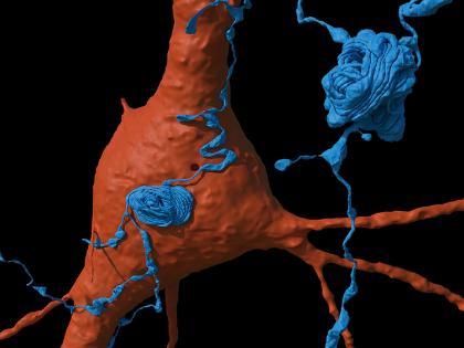 Against the background of a single neuron (orange), an axon (blue) emanating from another cell whorls itself into tangled balls.