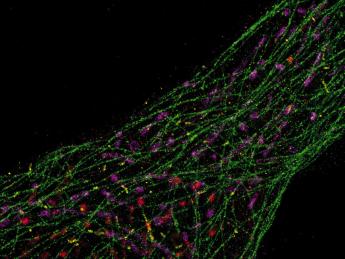 Super-resolution microscopy developed in the lab of Peng Yin allows researchers using conventional microscopes to see the inner workings of cells at the single molecule level. Above, microtubules (green) and mitochondria (purple) dominate the intracellular landscape.