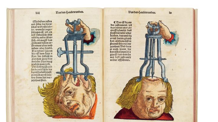 <i>Instruments for Use in Cranial Surgery,</i> from Hans von Gersdorff’s <i>Feldtbüch der Wundartzney</i> (1517), is both a <i>description</i> of how to remove shards of skull from the brain and a <i>tool</i> to persuade readers that such surgeries were possible.